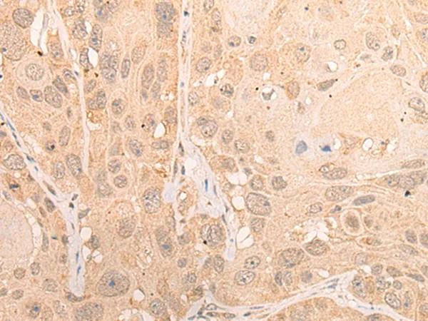 CPSF2 Rabbit Polyclonal Antibody - image 1