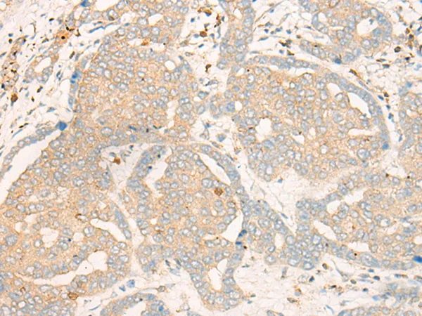 Fbx32 (FBXO32) Rabbit Polyclonal Antibody - image 1