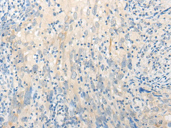 DISP2 Rabbit Polyclonal Antibody - image 1