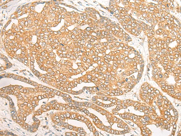 DOC2B Rabbit Polyclonal Antibody - image 1