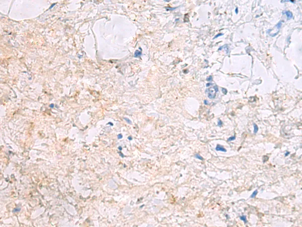 DPCD Rabbit Polyclonal Antibody - image 1