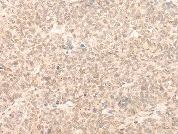 ELYS (AHCTF1) Rabbit Polyclonal Antibody - image 1
