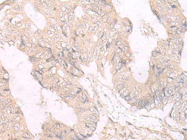 HLAC (HLA-C) Rabbit Polyclonal Antibody - image 1