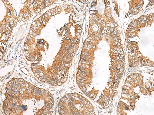 FERD3L Rabbit Polyclonal Antibody - image 1