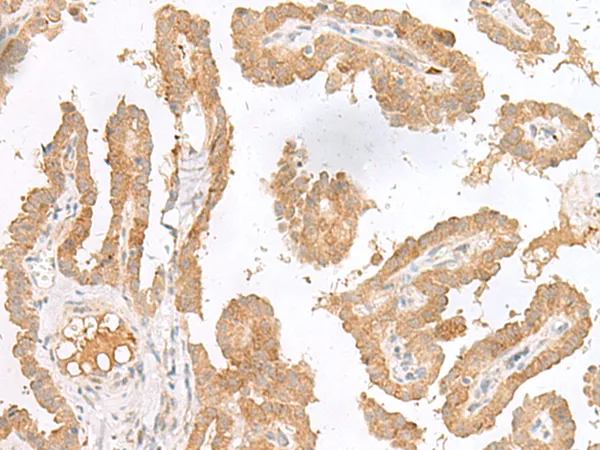 GCP2 (CXCL6) Rabbit Polyclonal Antibody - image 1