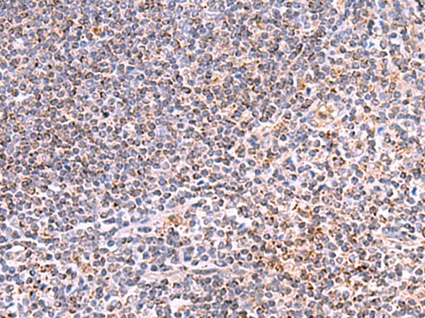 Heat Shock Factor 2 Binding Protein (HSF2BP) Rabbit Polyclonal Antibody - image 1