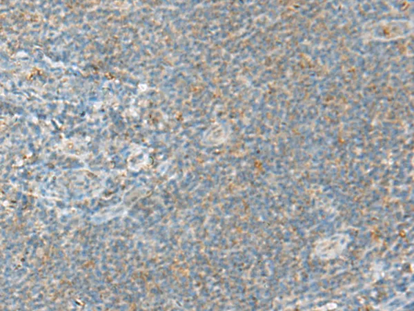 HECA Rabbit Polyclonal Antibody - image 1