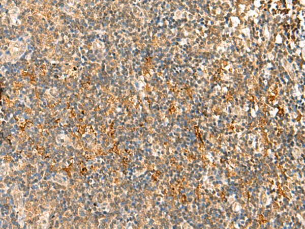 Huntingtin (HTT) Rabbit Polyclonal Antibody - image 1