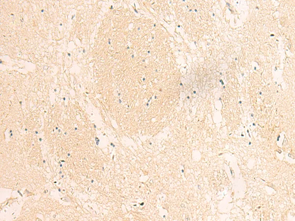 IF 2(Mt) (MTIF2) Rabbit Polyclonal Antibody - image 1