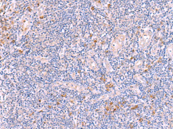 Integrin beta 7 (ITGB7) Rabbit Polyclonal Antibody - image 1