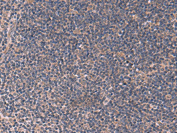 ITPR2 Rabbit Polyclonal Antibody - image 1