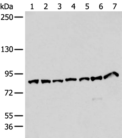 VPS35 Rabbit Polyclonal Antibody - image 1
