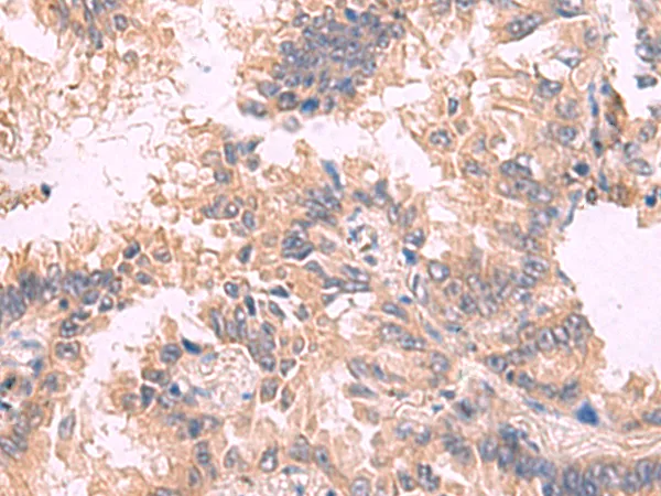 TJP1 Rabbit Polyclonal Antibody - image 1