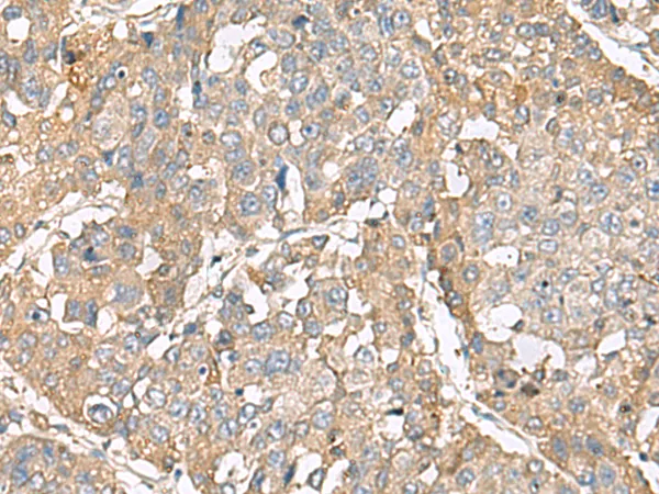 RBFOX1 Rabbit Polyclonal Antibody - image 1