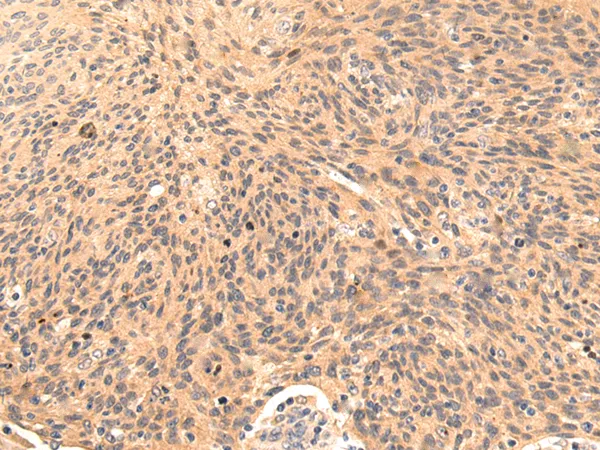 PI 3 Kinase catalytic subunit alpha (PIK3CA) Rabbit Polyclonal Antibody - image 1