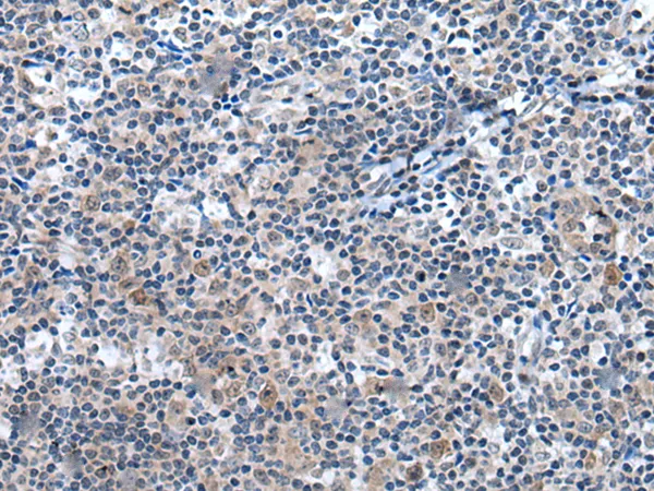 UCK2 Rabbit Polyclonal Antibody - image 1
