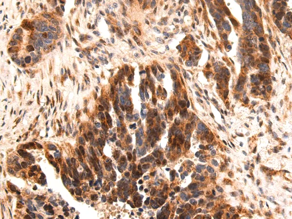 AP2 alpha (TFAP2A) Rabbit Polyclonal Antibody - image 1