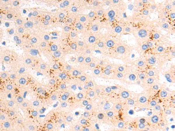 UNC5B Rabbit Polyclonal Antibody - image 1
