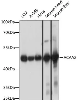 ACAA2 Rabbit Polyclonal Antibody - image 1