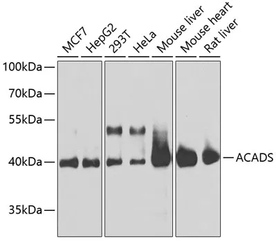 ACADS Rabbit Polyclonal Antibody - image 1