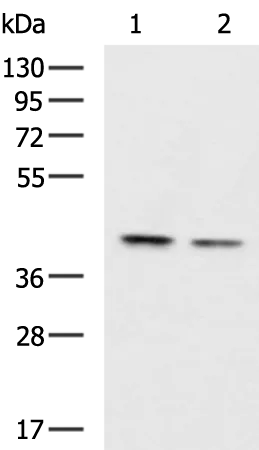 CSNK2A2 Rabbit Polyclonal Antibody - image 1
