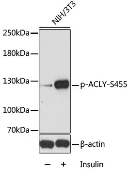 ATP citrate lyase (ACLY) Rabbit Polyclonal Antibody - image 1