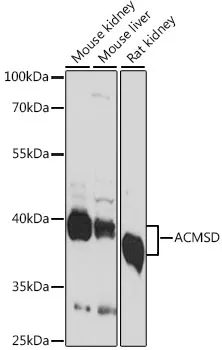 ACMSD Rabbit Polyclonal Antibody - image 1