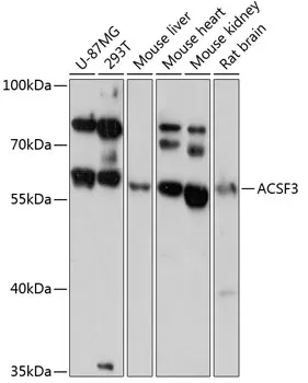 ACSF3 Rabbit Polyclonal Antibody - image 1