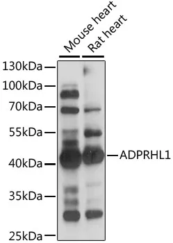 ADPRHL1 Rabbit Polyclonal Antibody - image 1