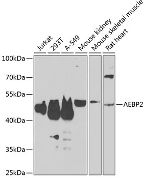 AEBP2 Rabbit Polyclonal Antibody - image 1