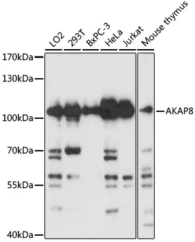 AKAP8 Rabbit Polyclonal Antibody - image 1