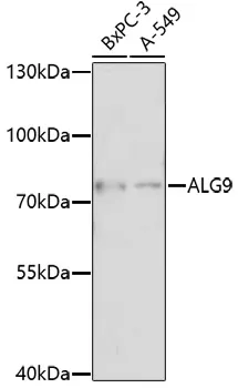 ALG9 Rabbit Polyclonal Antibody - image 1