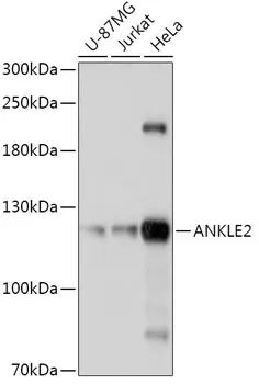 ANKLE2 Rabbit Polyclonal Antibody - image 1