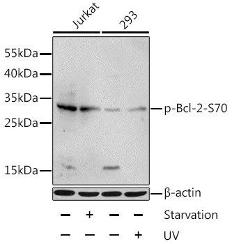 BCL2 Rabbit Polyclonal Antibody - image 1