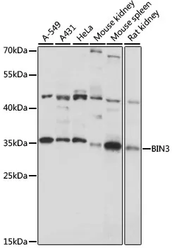 BIN3 Rabbit Polyclonal Antibody - image 1
