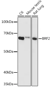 BRF2 Rabbit Polyclonal Antibody - image 1