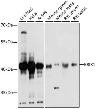 BXDC2 (BRIX1) Rabbit Polyclonal Antibody - image 1