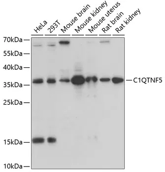 CTRP5 (C1QTNF5) Rabbit Polyclonal Antibody - image 1
