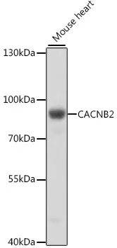 CACNB2 Rabbit Polyclonal Antibody - image 1
