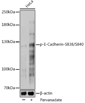 E Cadherin (CDH1) Rabbit Polyclonal Antibody - image 1