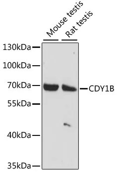 CDY1B Rabbit Polyclonal Antibody - image 1