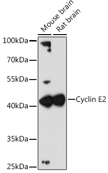 Cyclin E2 (CCNE2) Rabbit Polyclonal Antibody - image 1