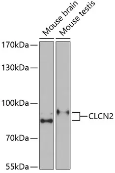 CLCN2 Rabbit Polyclonal Antibody - image 1