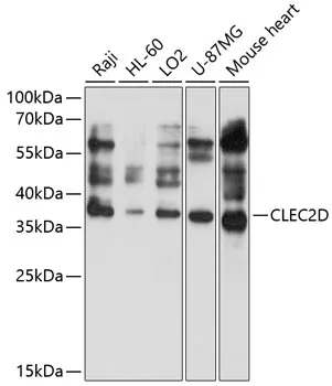CLEC2D Rabbit Polyclonal Antibody - image 1