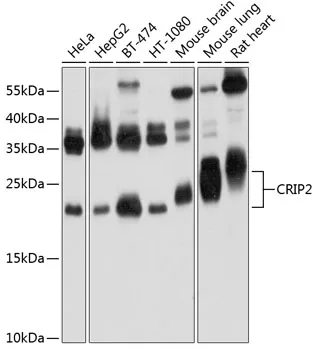 CRIP2 Rabbit Polyclonal Antibody - image 1