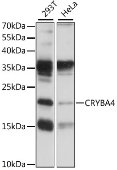 CRYBA4 Rabbit Polyclonal Antibody - image 1