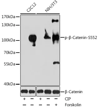 beta Catenin (CTNNB1) Rabbit Polyclonal Antibody - image 1