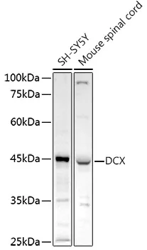 Doublecortin (DCX) Rabbit Polyclonal Antibody - image 1