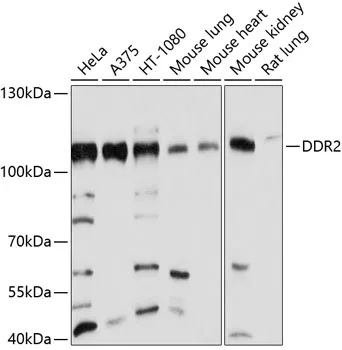 DDR2 Rabbit Polyclonal Antibody - image 1