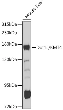 DOT1L Rabbit Polyclonal Antibody - image 1